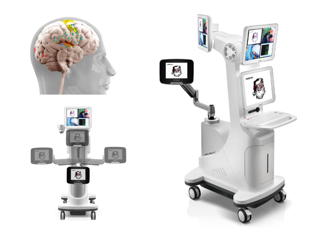 1673229622103142.jpg 腦功能術中刺激系統.jpg